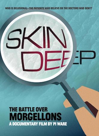 Skin Deep: The Battle over Morgellons  cover image